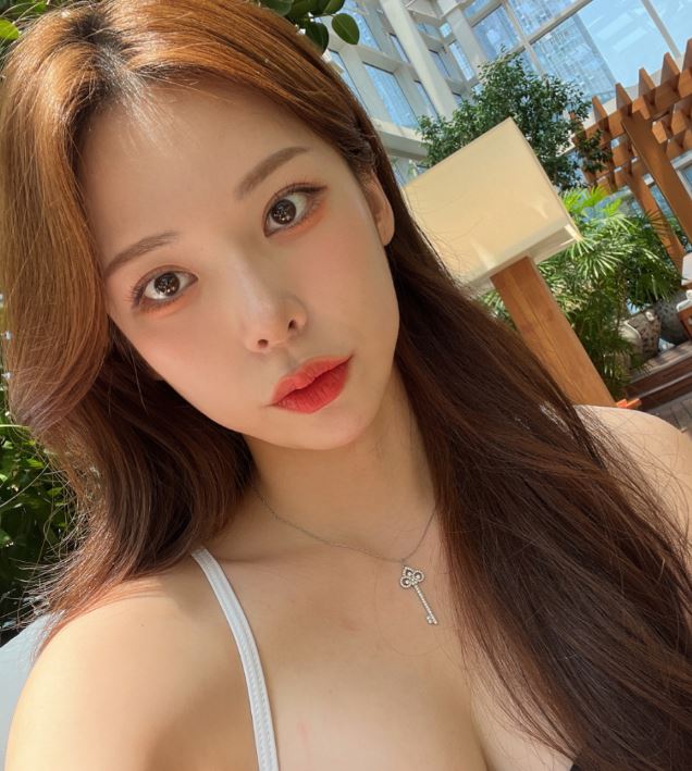 눈밑지방재배치 칙칙한 인상은 그만! 관련 이미지 1