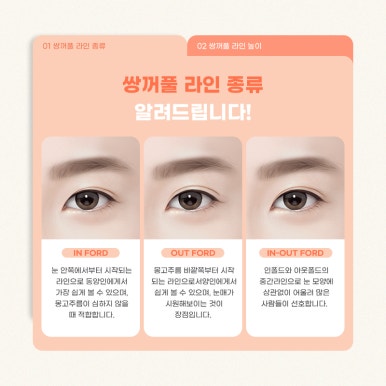 쌍수매몰 알아야 할 사실들 마블성형외과의원 관련 이미지 7