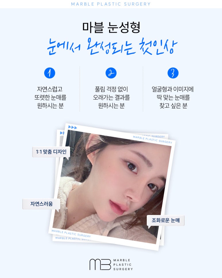 수험생눈성형 알아 볼 때 고려해야 할 것은? 관련 이미지 2