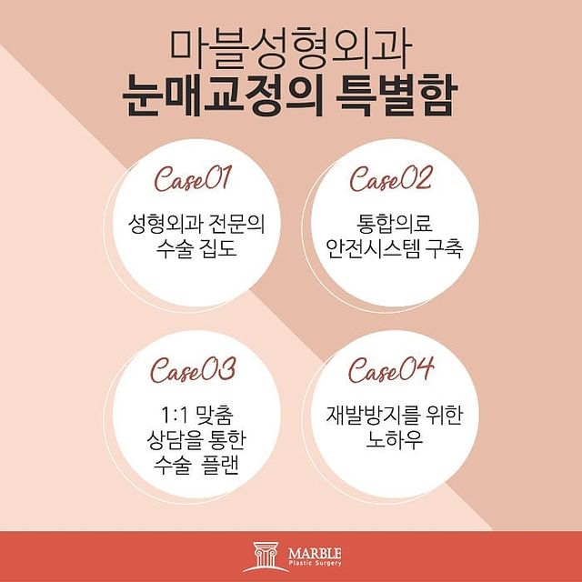비절개눈매교정 개인 차이에 따라 마블성형외과의원 관련 이미지 7