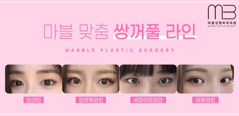 첫쌍수 리얼상세후기 마블 관련 이미지 16