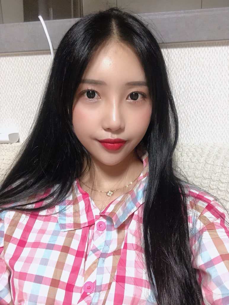 밑트임전후 색다르게 눈매 변화! 마블성형외과의원 관련 이미지 6