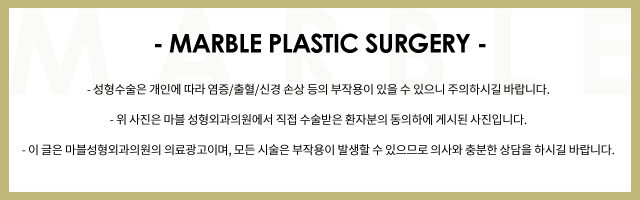 쌍수매몰 알고 싶은 모든 것 관련 이미지 8