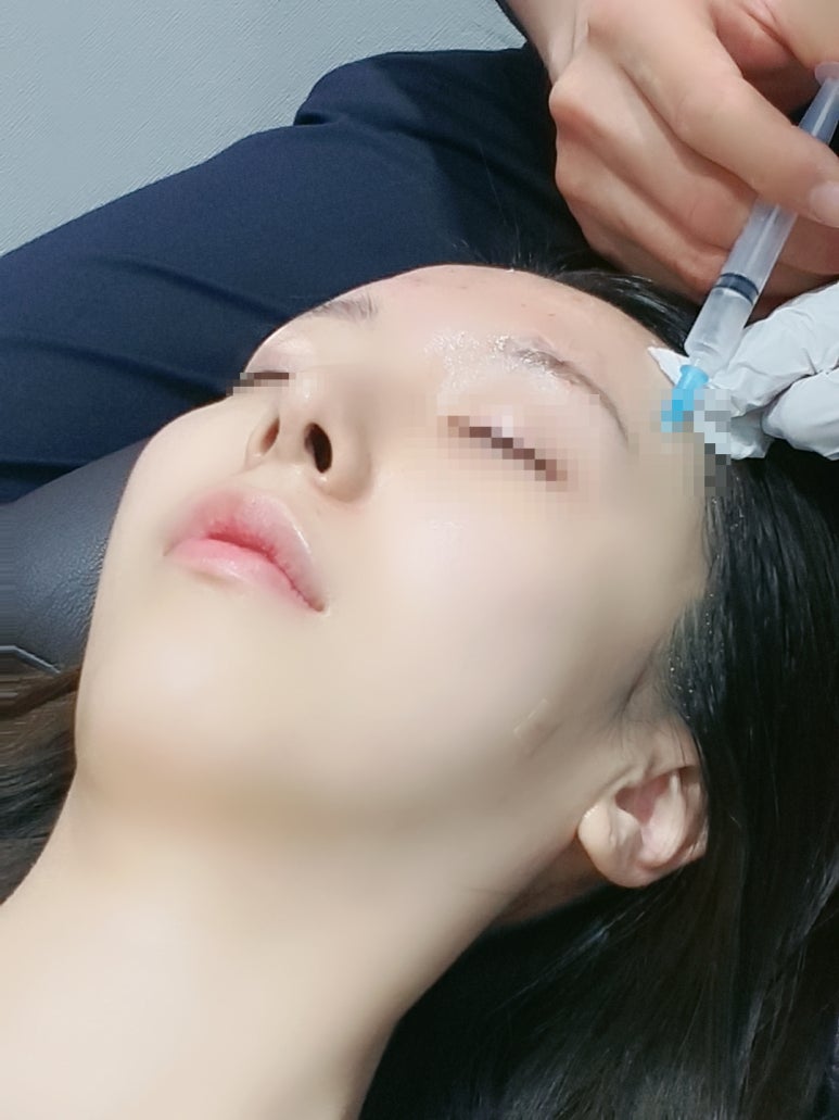 [닥터벨뷰 칼럼 62.] 쥬베룩은 안티에이징 시술의 꽃 관련 이미지 12