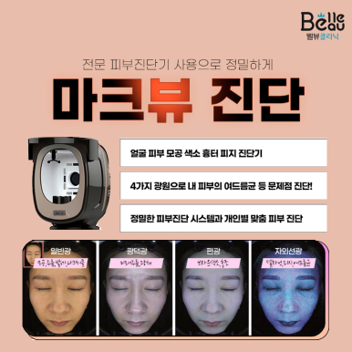 [닥터 벨뷰 칼럼 3.] LDM 물방울 리프팅, 피부가 민감하고 통증 못 참는 분에게 최적입니다 관련 이미지 14