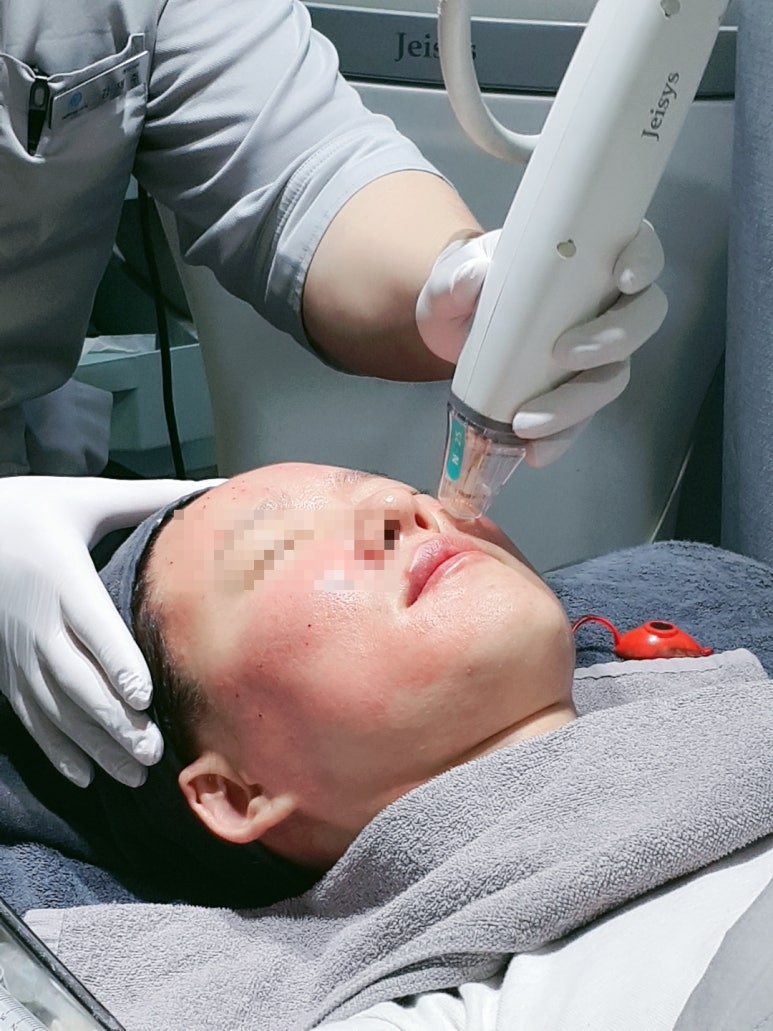 [닥터벨뷰 칼럼 26.] 리프팅, 드라마틱한 것보다 자연스럽게 하는 게 더 나은 이유 관련 이미지 5