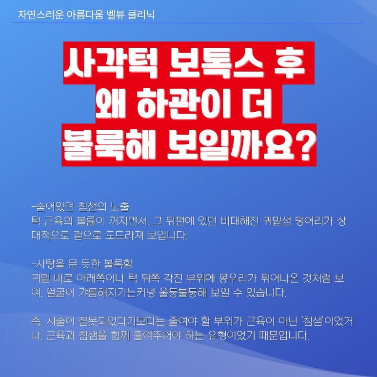 [닥터벨뷰 칼럼 113.] 사각턱 보톡스를 맞았는데 왜 하관이 더 부각될까요? (교근 보톡스와 침샘 보톡스의 결정적 차이) 관련 이미지 2