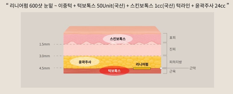 리프팅 입문자들을 위한 네 가지 프로그램, 벨뷰로 다 모여라! 관련 이미지 7