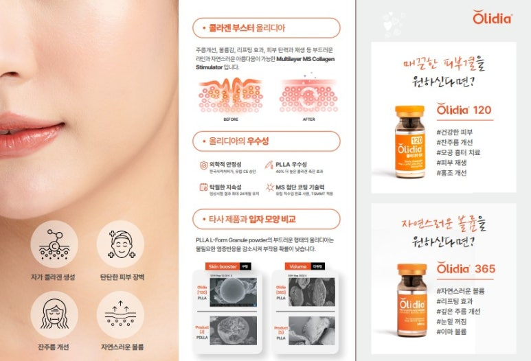 [닥터벨뷰 칼럼 104.] 결절 우려 없는 콜라겐 부스터는 없을까? 관련 이미지 8