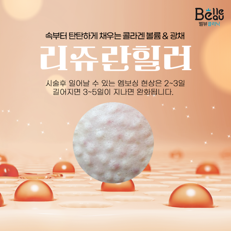 무통 리쥬란힐러? 에어녹스? 수면마취? 리쥬란힐러의 모든 것 관련 이미지 3