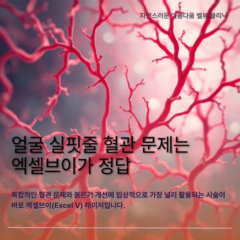 얼굴 실핏줄 만성 홍조 치료, 혈관 문제는 엑셀브이가 정답 관련 이미지 1