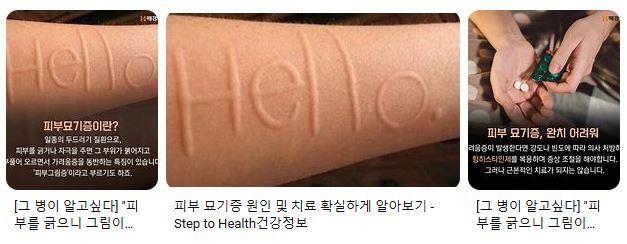 가려움증의 원인 이렇게 많았다니! 관련 이미지 5