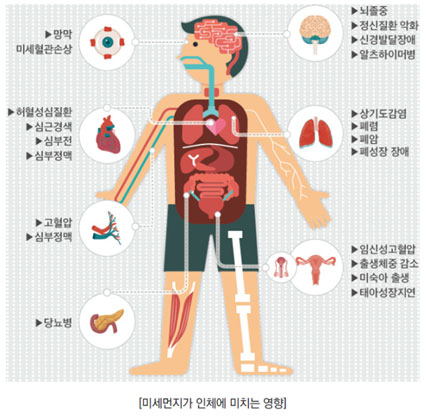 연일 이어지는 미세먼지 주의보, 피부에 끼치는 악영향 줄이려면 관련 이미지 3