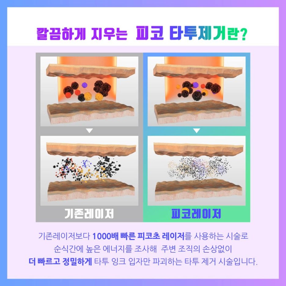 반영구눈썹문신 제거는 피코 레이저! 기미, 모공, 흉터 개선 효과까지 관련 이미지 11