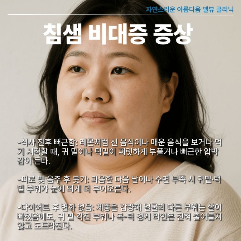 턱살인 줄 알았는데 침샘이라고? 귀밑&middot;턱밑 불룩함 해결하는 침샘 비대증 원인과 진단 관련 이미지 5