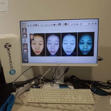 미간주름 원인과 치료, 매끈하고 볼륨있는 이마 만드는 방법 관련 이미지 5