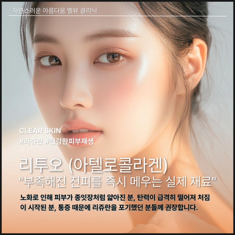 Comparing the 3 Major Skin Boosters [Rejuran, Juvelook, Lituo] image 6