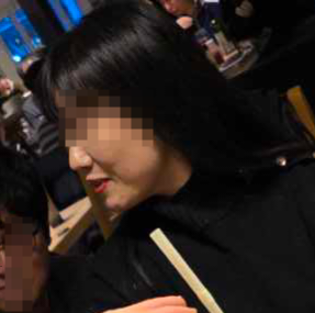 [닥터벨뷰 칼럼 64.] 피부가 얇고 입가, 볼살, 턱살 처짐이 있는 40대 여성의 리프팅 추천 관련 이미지 2