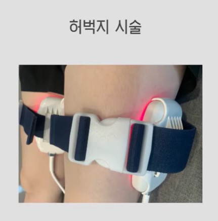 똘똘 뭉친 셀룰라이트로 고민해보셨나요? (feat. 노블쉐이프) 피부과에서 편하게 받는 셀룰라이트 치료 관련 이미지 10