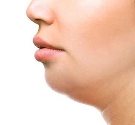 [닥터벨뷰 칼럼 94.] 굴곡진 땅콩형 얼굴, 무조건 당기는 리프팅이 정답이 아닌 이유 관련 이미지 2