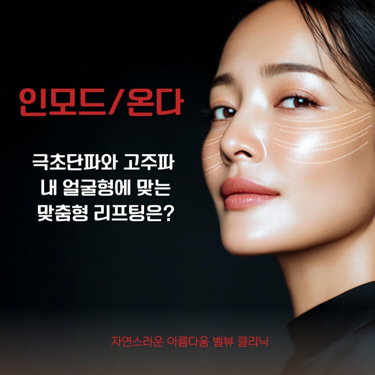 The Battle Between Microwaves and Radiofrequency: How to Choose a Customized Lifting Treatment for Your Face Shape [ONDA vs. InMode] image 1