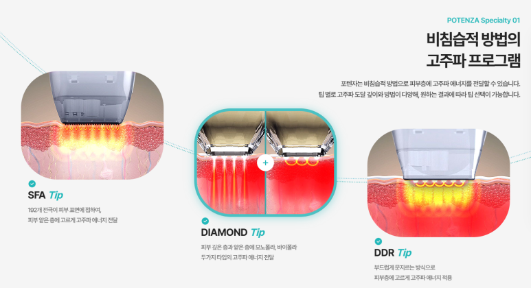 포텐자 치료 효과, 일본인에게 특히 인기인 이유는? 관련 이미지 4
