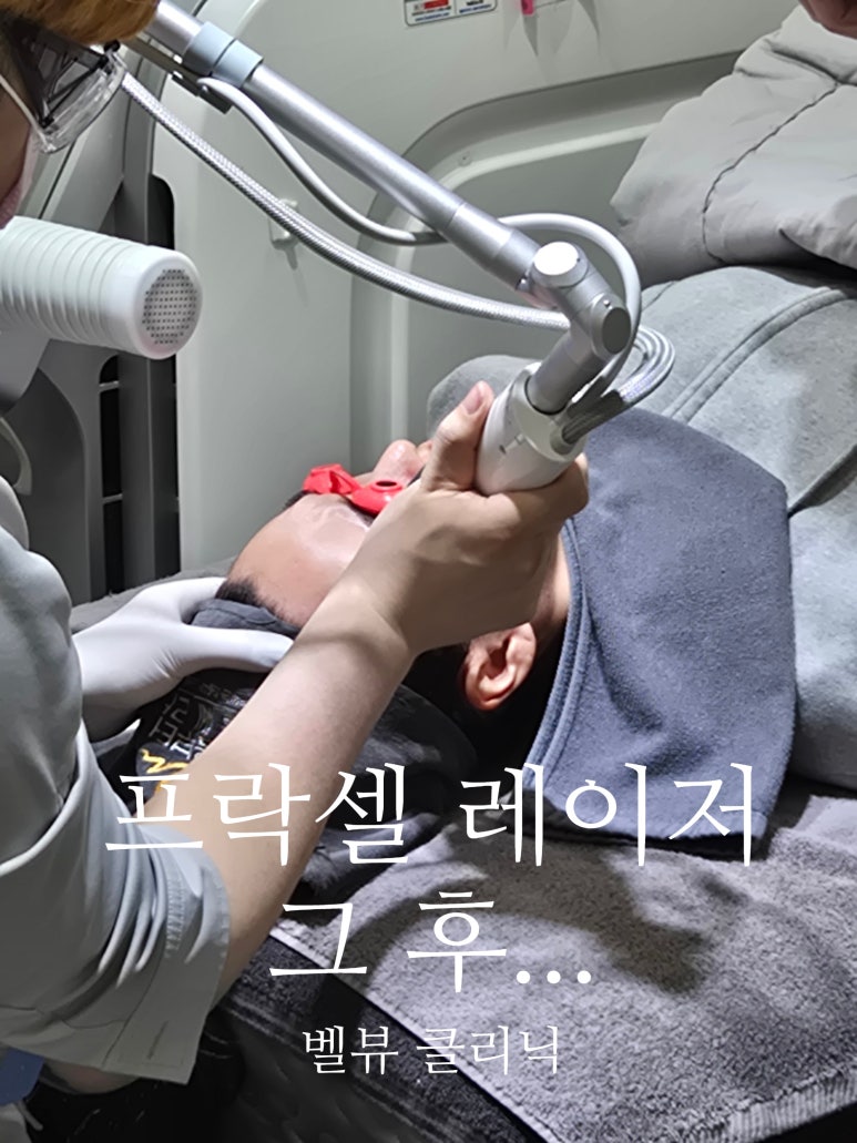 프락셀 레이저 후 피부 반응(붉음, 가려움, 건조, 유분 과잉의 비밀) 시술 후 피부관리 이렇게 해요 관련 이미지 1