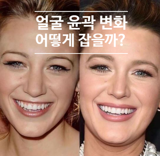단 한 번의 리프팅으로 얼굴 윤곽 완성되는! 벨뷰 울써마지 관련 이미지 2
