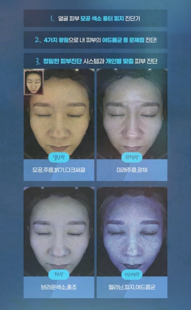 자꾸 모공이 커질 때는 어떤 피부과 시술이 좋을까? 마크뷰 정밀 진단 검사 받아보세요 관련 이미지 13
