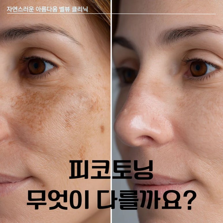 칙칙한 잡티와 난치성 기미, 왜 관련 이미지 1