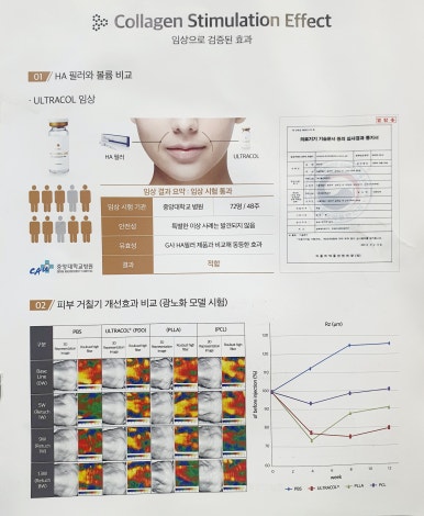 안전한 콜라겐 부스터이자 필러 대체품 관련 이미지 12