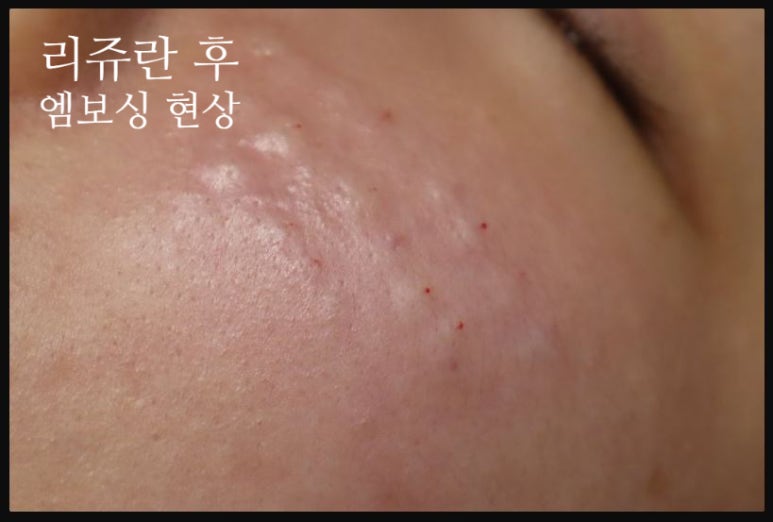 수면리쥬란 안전하게!체크리스트 확인하세요 관련 이미지 2