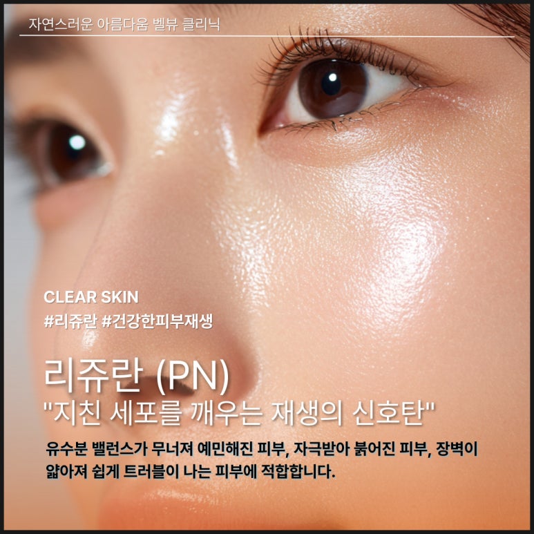 Comparing the 3 Major Skin Boosters [Rejuran, Juvelook, Lituo] image 4