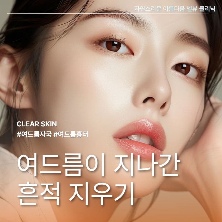 여드름 자국과 여드름 흉터 구별법, 프락셀을 맞으면 좋은 경우와 안 좋은 경우는? 관련 이미지 1