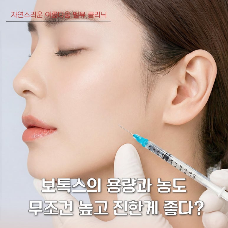 Should Botox Be Administered Before Wrinkles Appear or After They Form? image 4