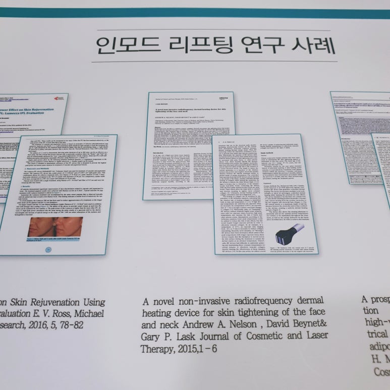 벨뷰 클리닉 인모드 리프팅, 어떤 얼굴에 효과적일까? 관련 이미지 9