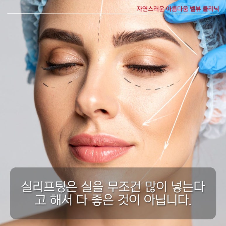 [닥터벨뷰 칼럼 114.]"실리프팅은 나이 들어서 하는 거 아닌가요?" 피부과 의사가 밝히는 실리프팅의 오해와 진실 관련 이미지 5