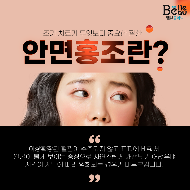볼 빨간 안면홍조 잘 치료하는 혈관 레이저 엑셀브이 관련 이미지 3