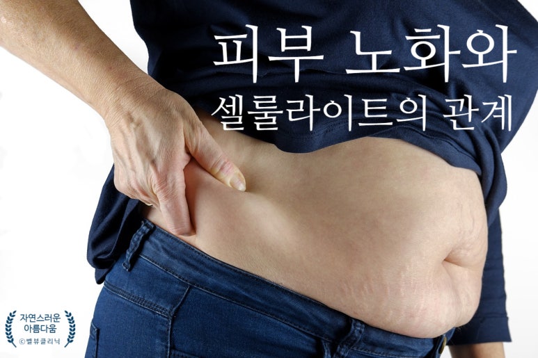 The Key to Removing Midlife Belly Fat Is Breaking the Link Between [Skin Aging - Cellulite Accumulation] image 2