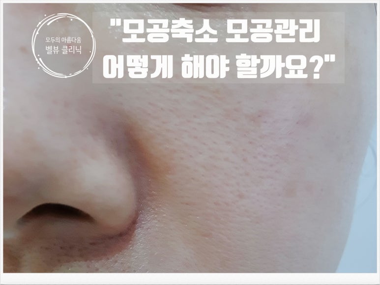 모공축소 모공관리 어떻게 해야 할까요? 관련 이미지 4