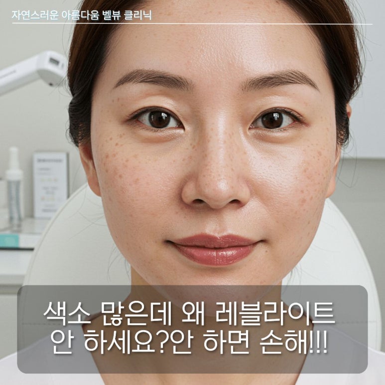 색소 많은데 왜 레블라이트 안 하세요?안 하면 손해!!! 관련 이미지 1