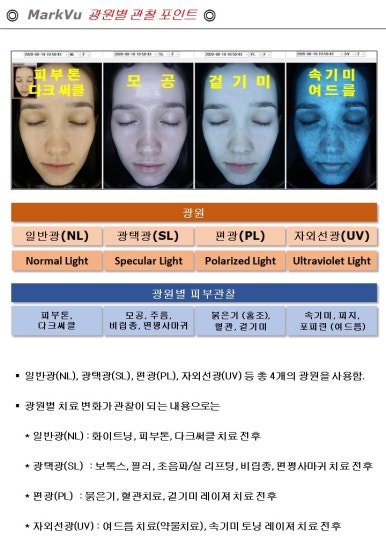 [닥터 벨뷰 칼럼 4.] 호두턱, 자갈턱 원인과 치료, 예방법 총정리 관련 이미지 9