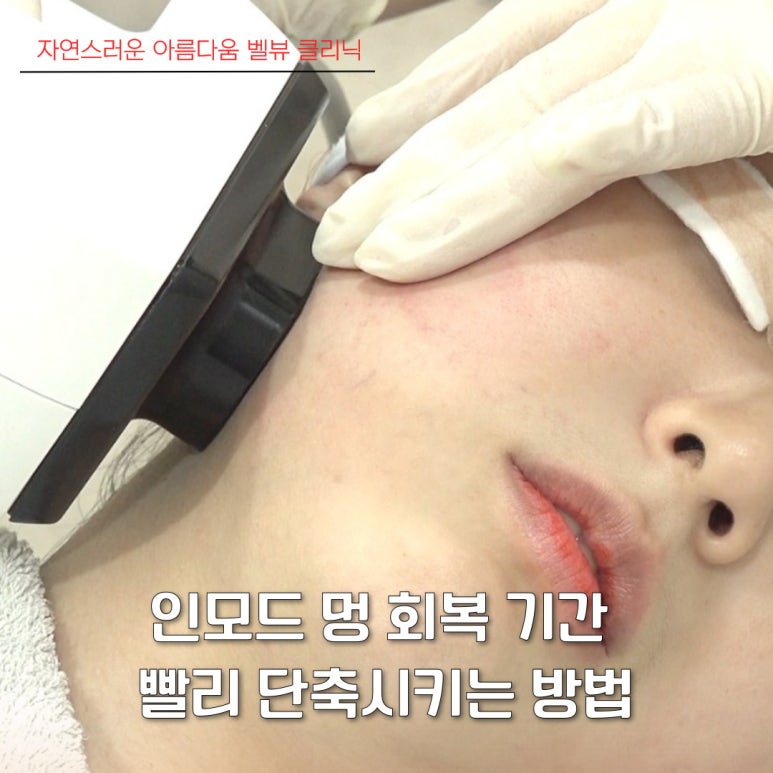소리 소문 없이 매끄럽게, 인모드 멍 회복 기간 빨리 단축시키는 방법 관련 이미지 1