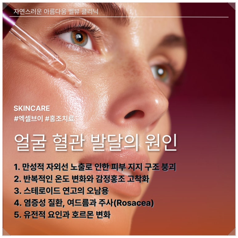 Causes of Vascular Dilation, a Case of Skin Flare-Up and Sensitivity After Facial Paralysis, and Excel V image 2