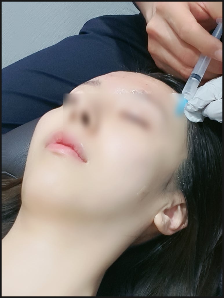[Dr. Bellview Column 90.] Luxury Skin Completed by a Hair’s Breadth of Difference: Why the Dosage of Skin Boosters Determines the Details of the Result image 2