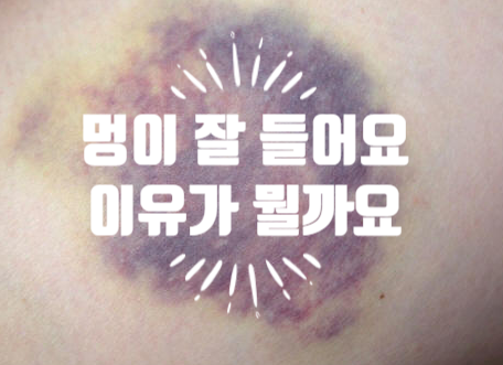 [닥터벨뷰 칼럼 20.] 성형외과 피부과 시술 후 유독 멍이 잘 드는 사람 관련 이미지 1