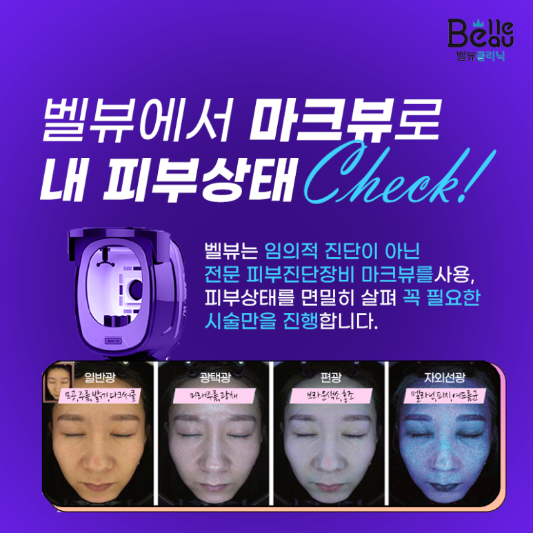 올리지오 리프팅 효과, 시술주기, 필요샷수 모두 알려드려요 관련 이미지 7