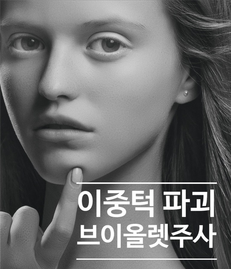 Powerful V-Liolet Injection That Destroys a Double Chin image 2