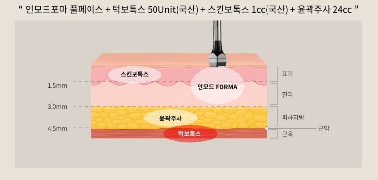 리프팅 입문자들을 위한 네 가지 프로그램, 벨뷰로 다 모여라! 관련 이미지 5