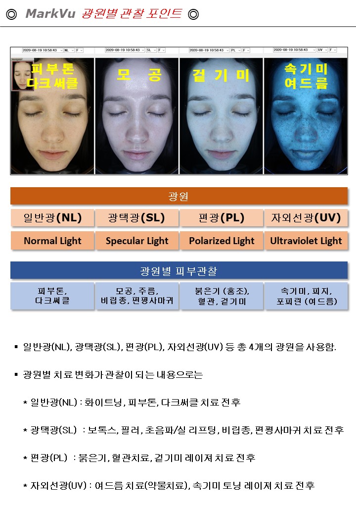 손발에 이유 없이 물집이 잡혀요~ 한포진 기초정보 관련 이미지 9